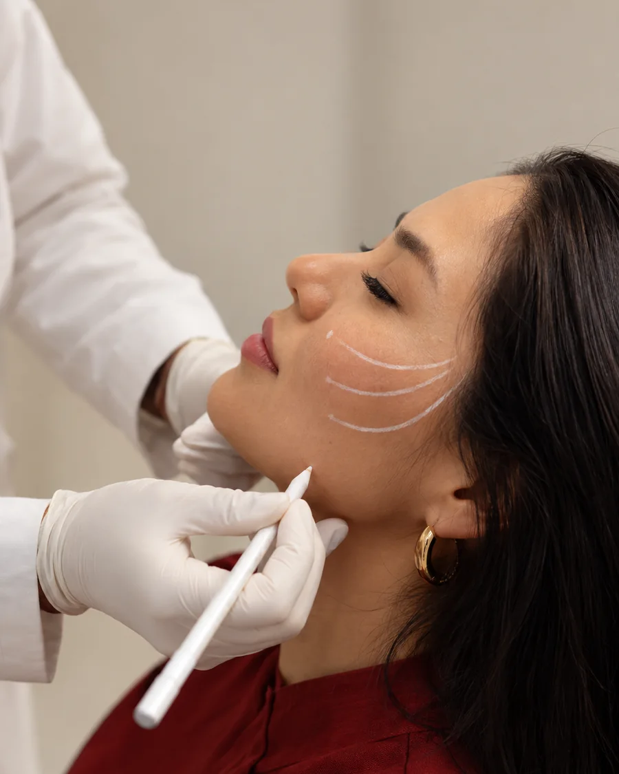 Profissional marca o rosto de uma paciente com lápis dermatográfico