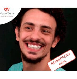 Reabilitação Oral - Volte a sorrir sem medo