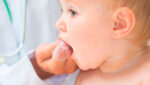 Higiene bucal dos Bebês