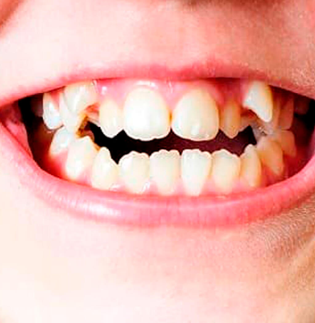 várias bocas em posições diferentes. com dentes, língua, sorriso