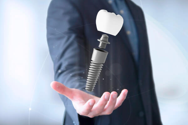 Clínica Implantes Dentários