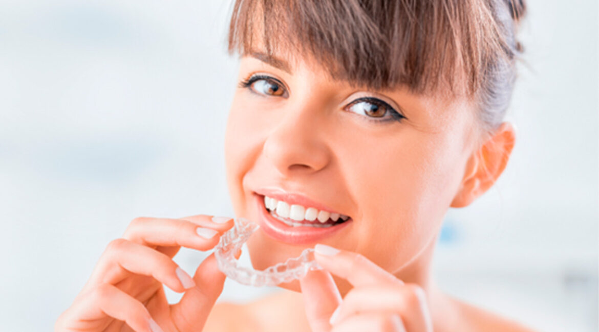 Alinhadores Invisíveis