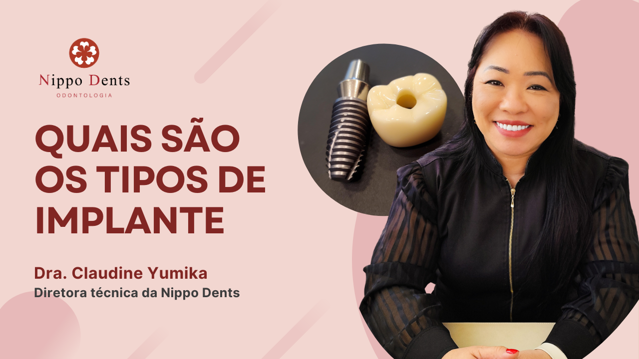 Banner informativo sobre os tipos de implantes dentários com Dra. Claudine