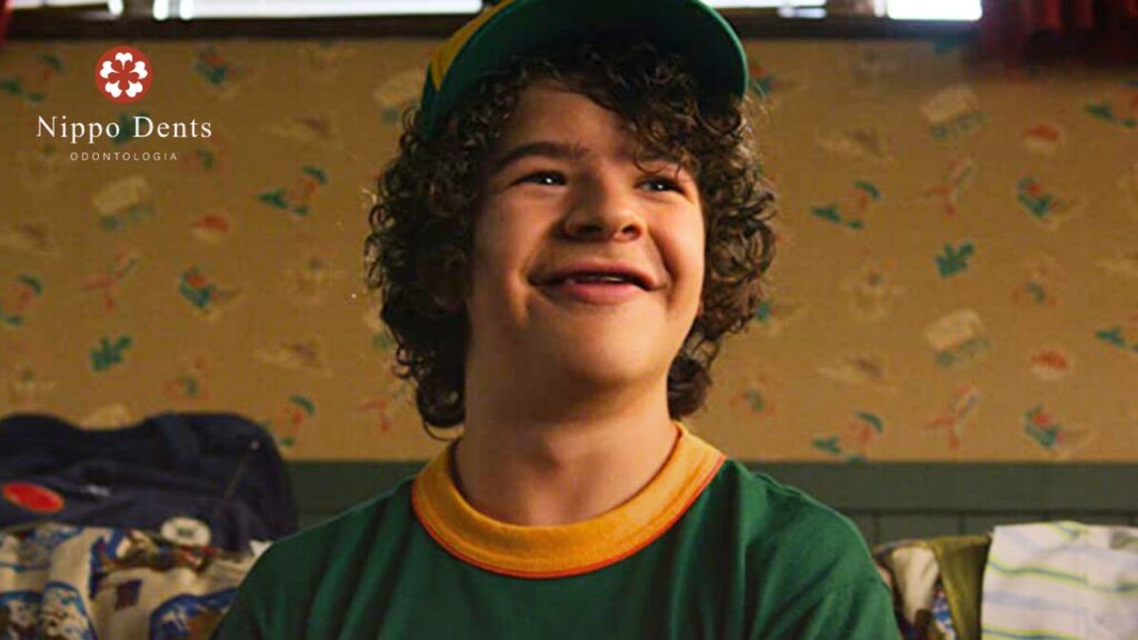 Personagem Dustin Henderson da série stranger things que apresenta características associadas à displasia cleidocraniana