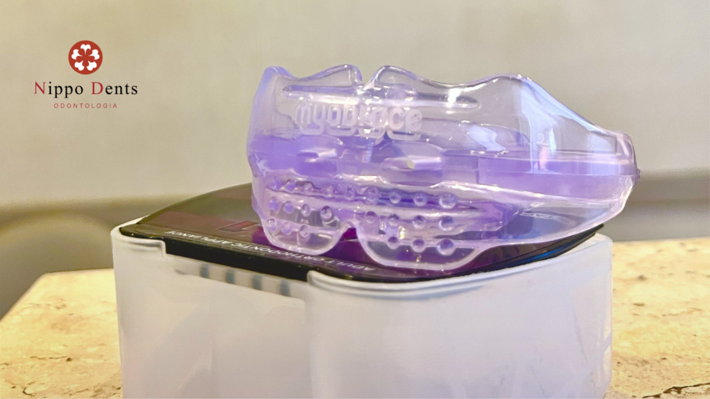 Aparelho Miofuncional utilizada para correção de maus hábitos miofuncionais