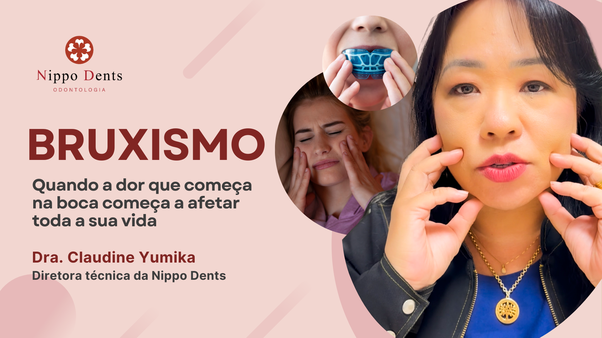 Bruxismo pode causar dor na mandíbula, tensão facial, problemas no sono e impacto na qualidade de vida