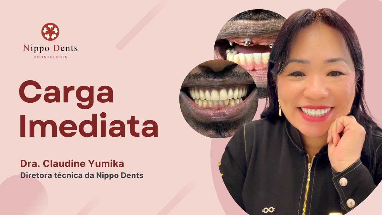 Dra. Claudine Yumika apresentando o tema carga imediata com exemplos de antes e depois