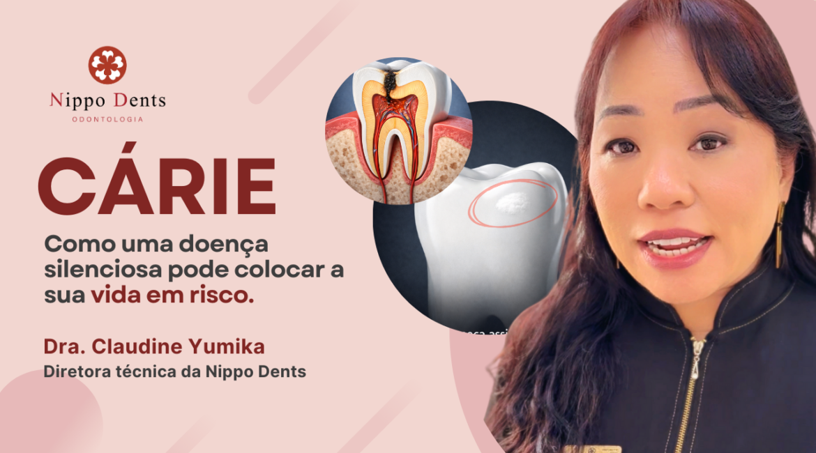 Capa do artigo da Dra. Claudine Yumika sobre o impacto sistêmico da cárie na saúde
