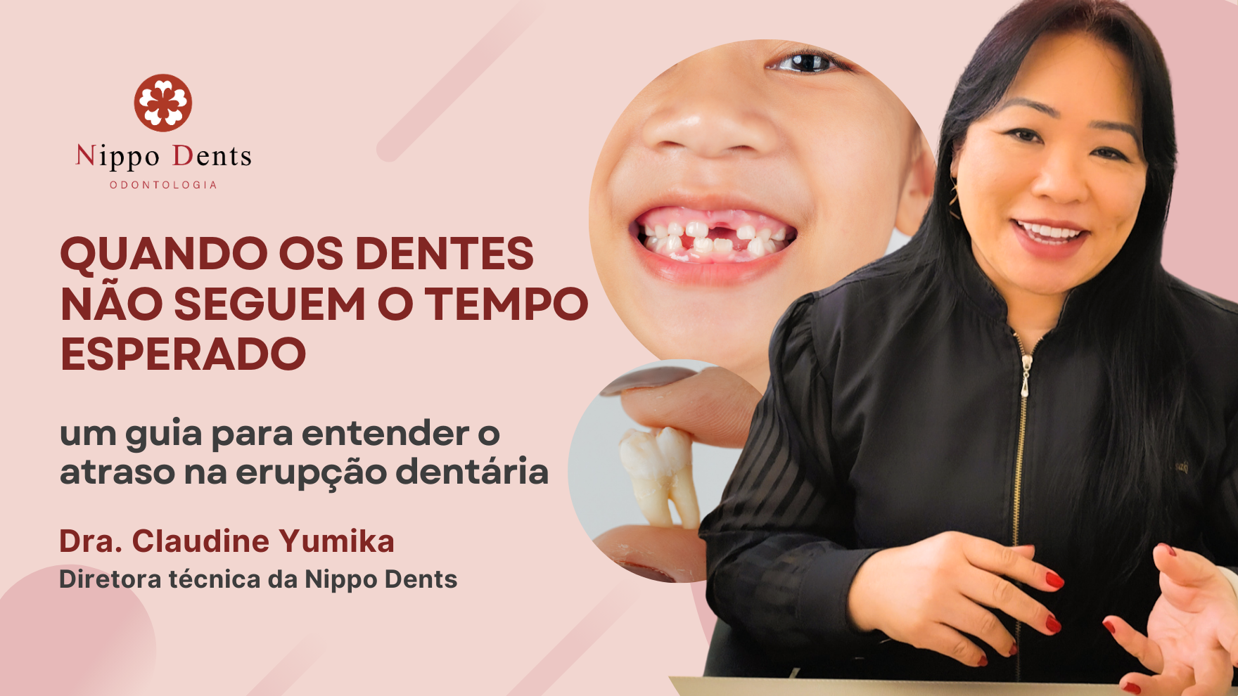 Capa do artigo sobre atraso na erupção dentária, com criança sorrindo e Dra. Claudine Yumika explicando o tema