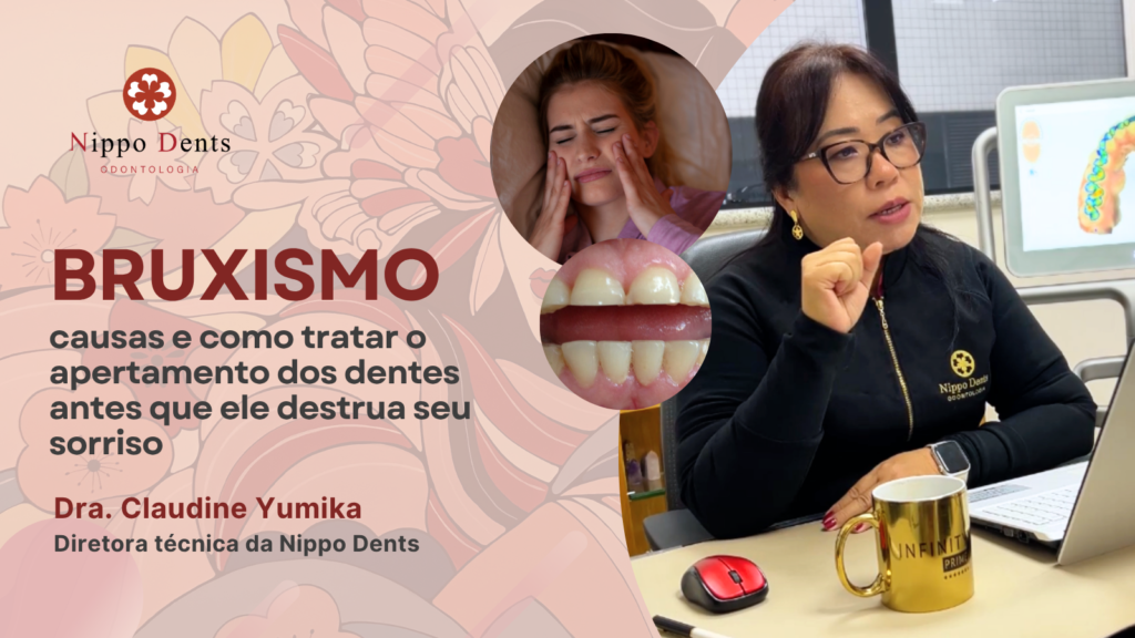 Imagem ilustrativa sobre bruxismo mostrando sintomas como dor na mandíbula, ranger dos dentes e desgaste dental