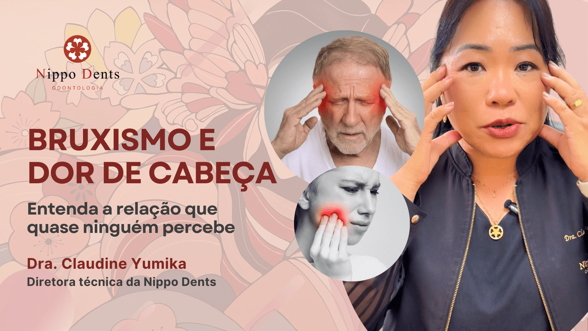 Imagem ilustrativa mostrando relação entre bruxismo, tensão mandibular e dor de cabeça frequente