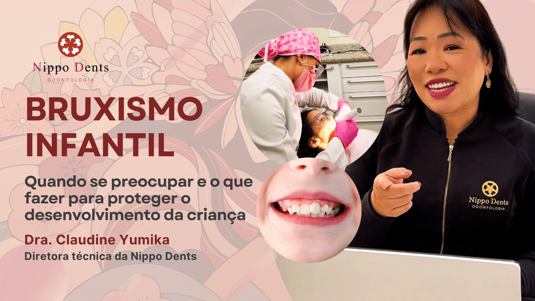 Imagem ilustrativa sobre bruxismo infantil mostrando criança com ranger de dentes durante o sono