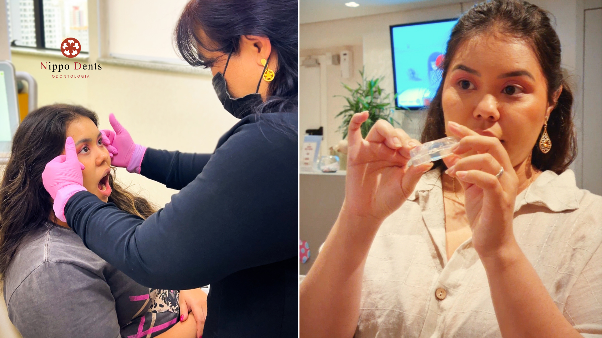 Paciente realizando tratamento miofuncional para bruxismo com foco em musculatura facial e função oral