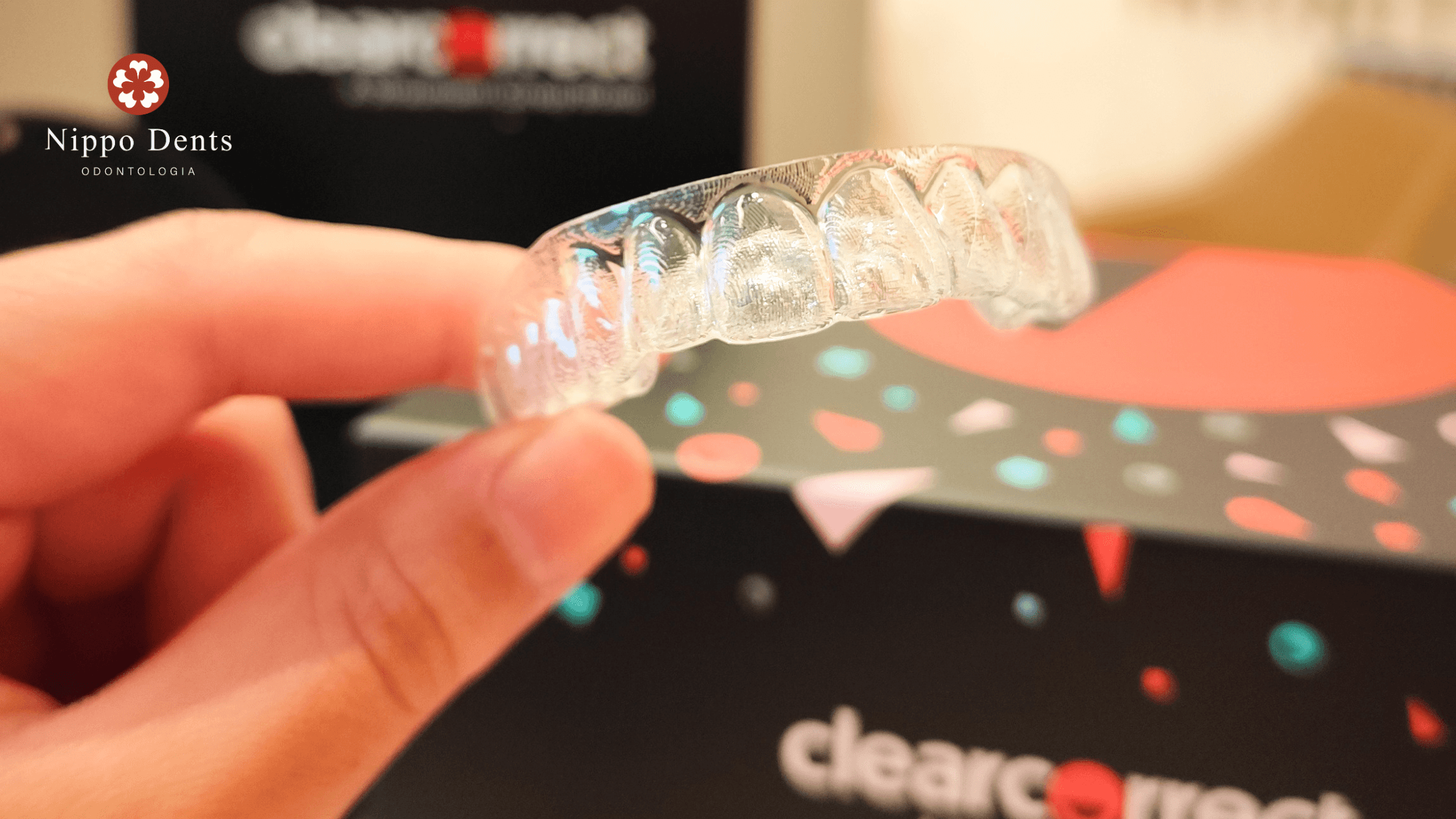 Close-up de alinhador transparente Clear Correct utilizado para alinhamento dental discreto.